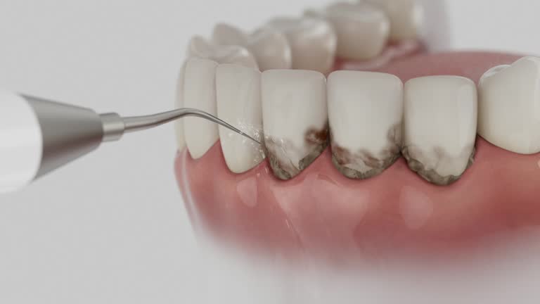 Trusted Tooth Extraction service in Ypsilanti, MI - Dentist Open Now